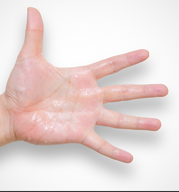Wet Hand | Laguna Dermatology in Laguna Hills, CA