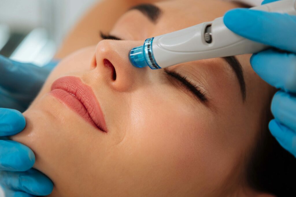HydraFacial for Acne-Prone Skin Clearing Blemishes and Restoring Clarity