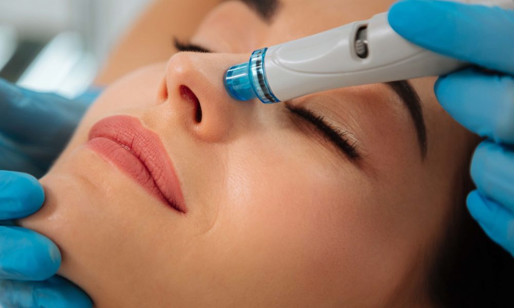 HydraFacial for Acne-Prone Skin Clearing Blemishes and Restoring Clarity